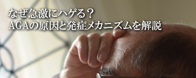 AGAの原因とメカニズム
