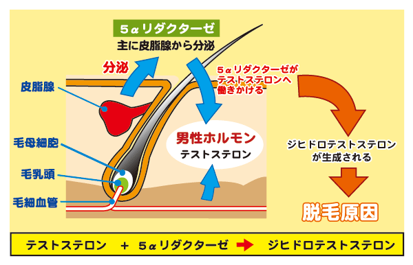 AGAの原因である男性ホルモン