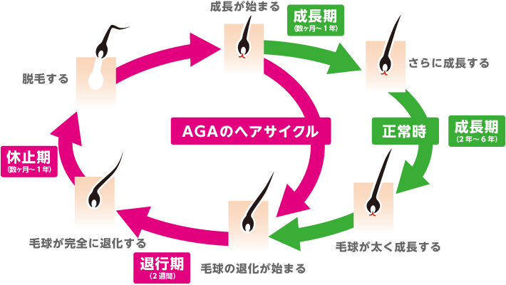 AGA(男性型脱毛症)のサイクル