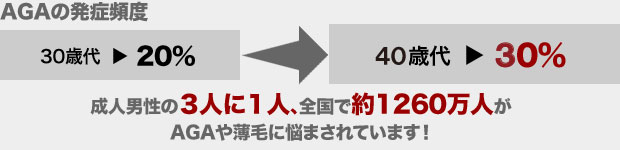AGAの発症は30代や40代がほとんど!