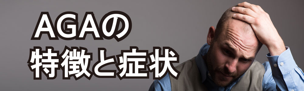 AGAの発症と特徴