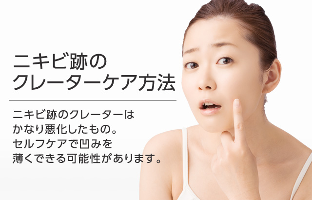 陥没クレータータイプニキビ