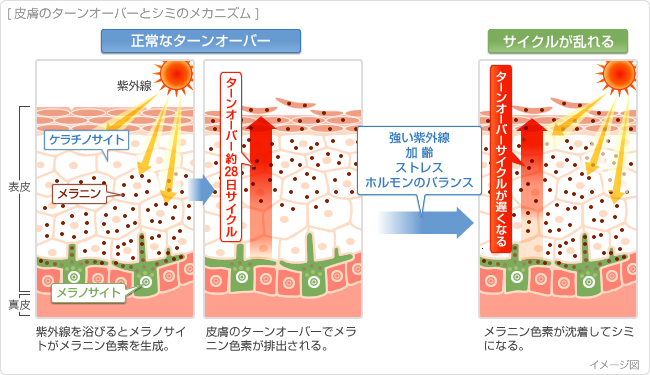 シミになるメカニズム