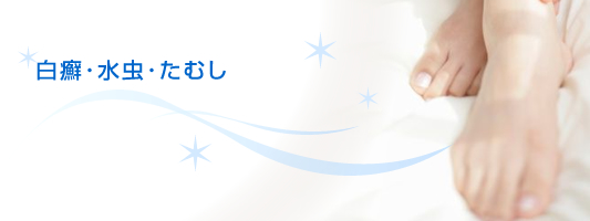 いんきんたむしの症状と治療薬