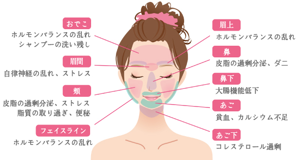 ニキビの出来やすい個所