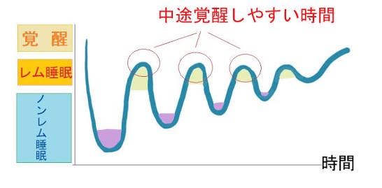 中途覚醒