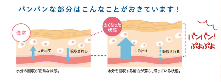 むくみは水分が異常増加する