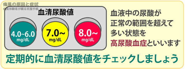 痛風は高尿酸血症になるとかかりやすい