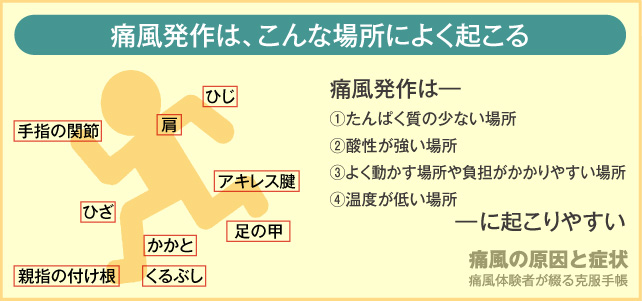 痛風で痛む箇所
