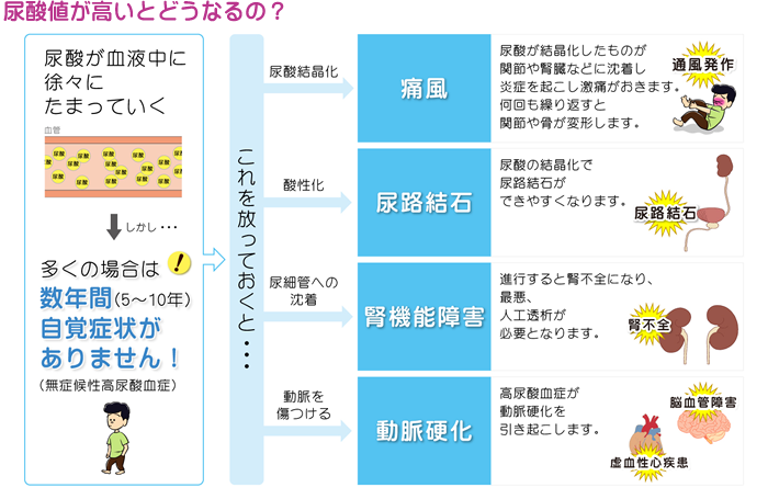 痛風を放置すると