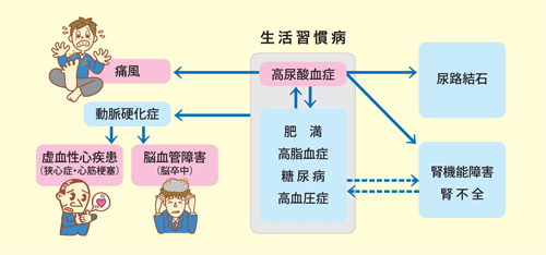 痛風は他の病気を併発しやすい